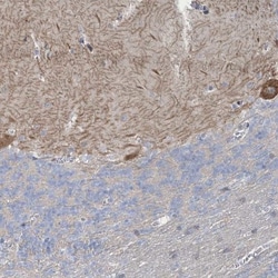 SHANK1 Antibody, Novus Biologicals 25 &mu;L, Unlabeled:Antikörper